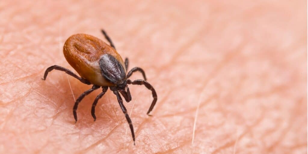 Una zecca di cervo, un insetto mordace parassita sullo sfondo dell'epidermide umana.