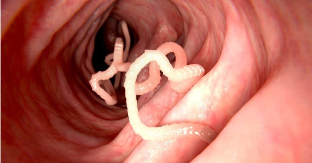 Tenie in un intestino umano.