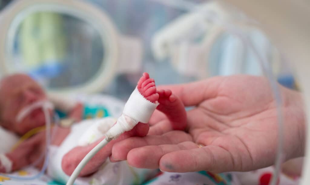 Bambino prematuro