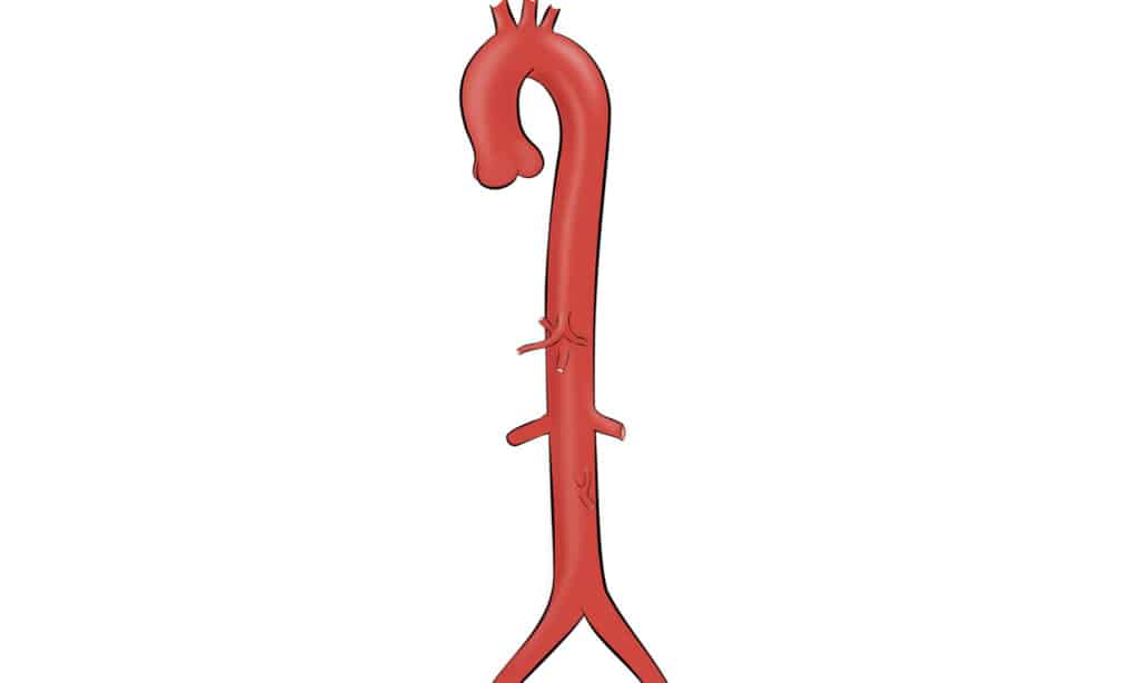 aorta