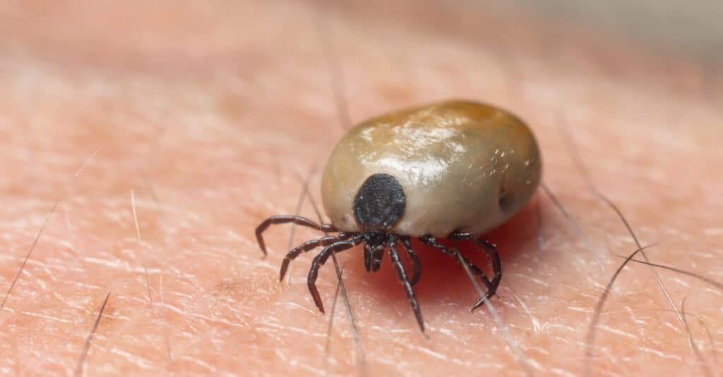 Una zecca di cane ubriaca di sangue striscia sulla pelle umana.
