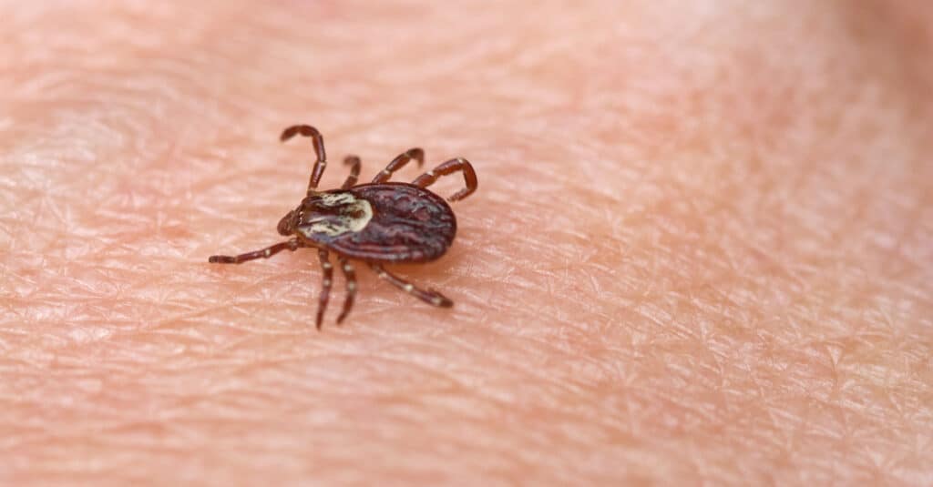 American Dog Tick (Dermacentor variabilis) sulla pelle umana.