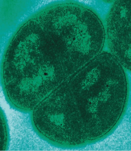 Deinococcus radiodurans "il microbo Lazarus". 