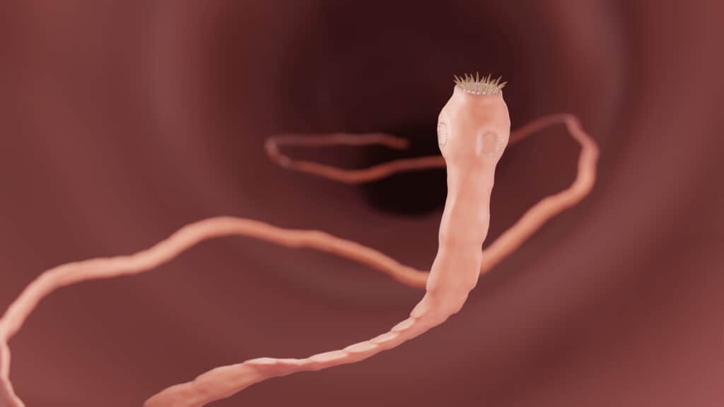 Tenia nell'intestino