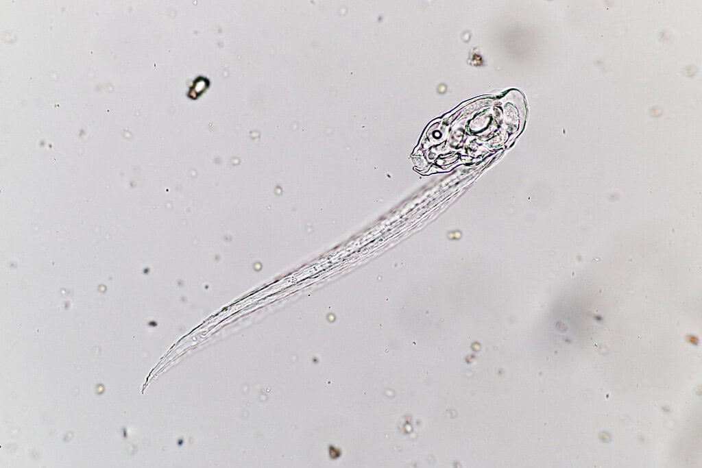 Larvacea (protozoi marini) al microscopio