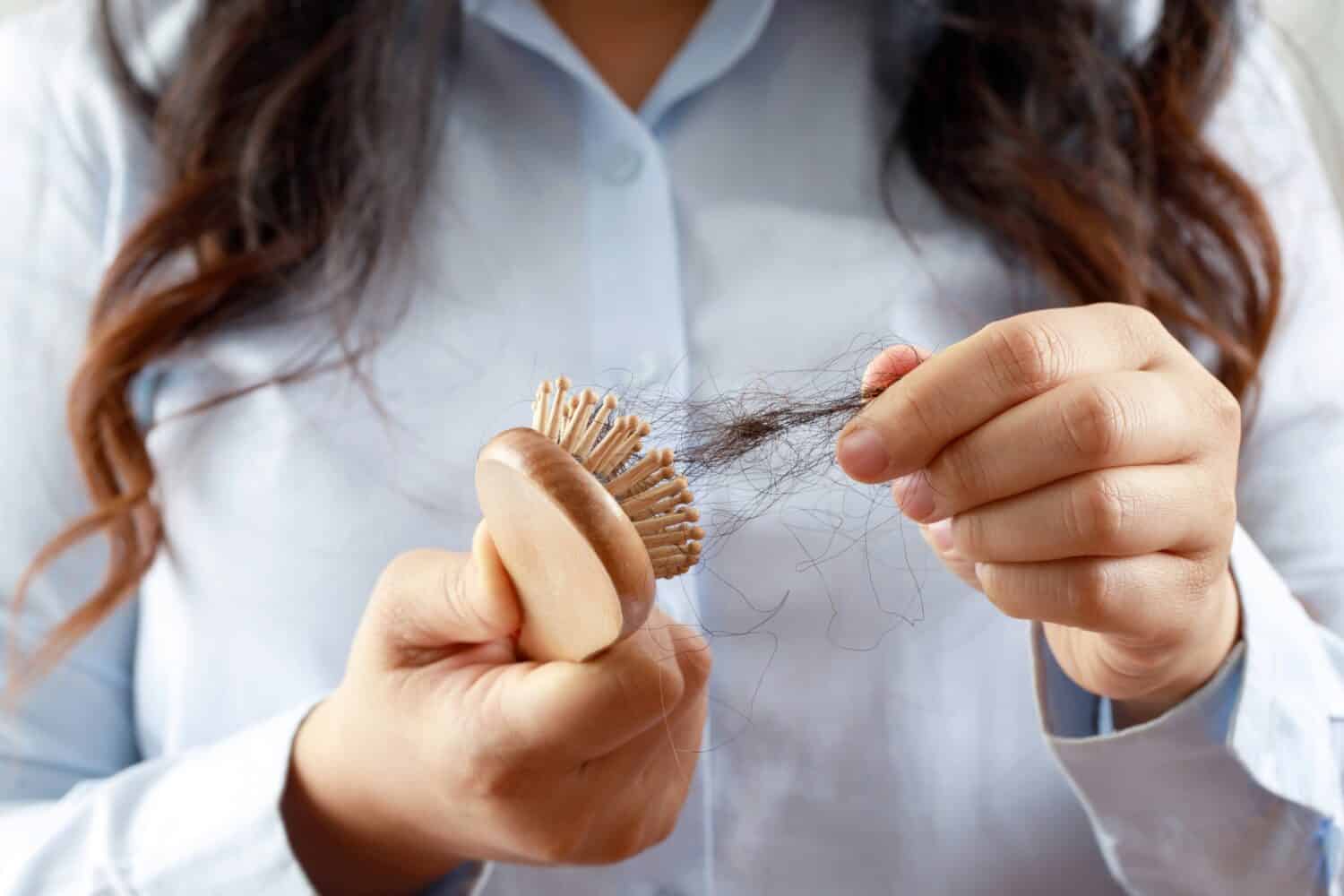 Vista posteriore giovane donna preoccupata per il problema della perdita dei capelli, squilibrio ormonale, concetto di stress.  Molti capelli cadono dopo averli pettinati con la spazzola in mano.  La femmina districò i capelli con un pettine, assistenza sanitaria